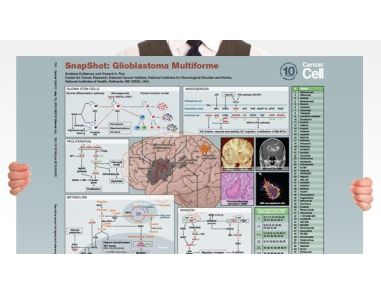 SnapShot: Glioblastoma Multiforme
