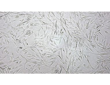 Characterization of MSCs Cultured in Xeno-Free MesenCult™-XF
