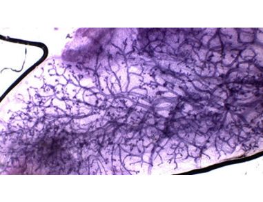Assays for Mammary Epithelial Stem and Progenitor Cells