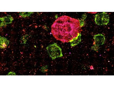 Defining Characteristics of Bona Fide Human iPS Cells