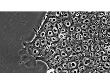A Step Closer to Clinically-Compatible Culture of hESCs and hiPSCs with TeSR&trade;2
