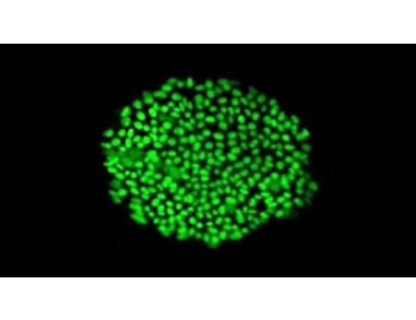 Feeder-Independent Culture of hESCs and hiPSCs with mTeSR™1