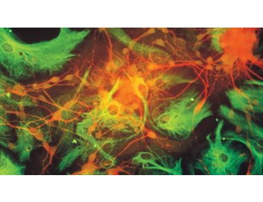 Standardized Media and Reagents for Neural Stem Cell Research with NeuroCult™