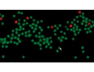 Cell Separation Solutions for HLA and Chimerism Analysis