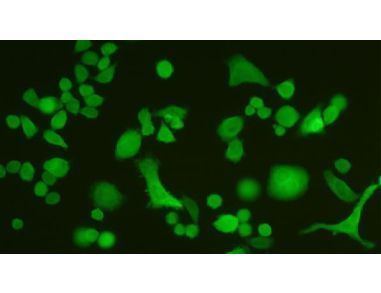 ALDEFLUOR™ and Cancer Stem Cells