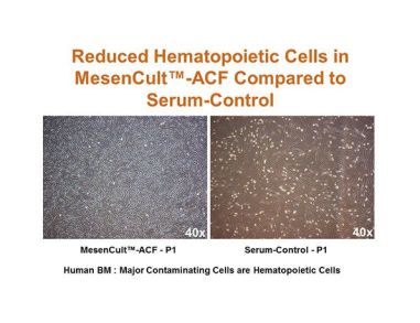 A Novel, Animal Component-Free (ACF) Culture System for Efficient Isolation, Expansion and Cryopreservation of Human MSCs