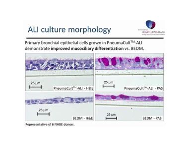 PneumaCult™-ALI: An Improved Medium Formulation for the Differentiation of Human Bronchial Epithelial Cells