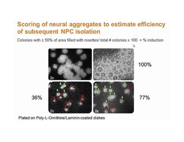 Tired of Manual Neural Rosette Isolation? How to Form and Isolate More Efficiently