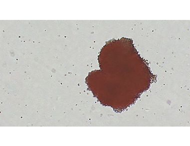 A Guide to Erythropoiesis - EPO Signaling and Erythroid Development