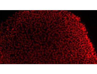 Groundbreaking Applications of Feeder-Free hESC & hiPSC Culture