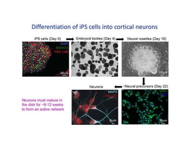 Neuronal Phenotyping of an iPS Cell Model of Rett Syndrome