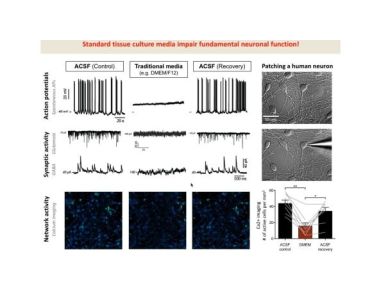 The Road to Functional Human Neuronal Circuits in Vitro 