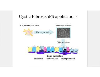 Making Lung Cells from Pluripotent Stem Cells: Disease Modeling and Future Therapies