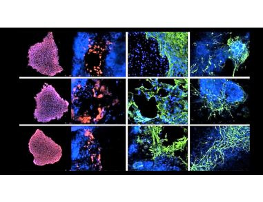 Modeling Genetic Epilepsies with Induced Pluripotent Stem Cells