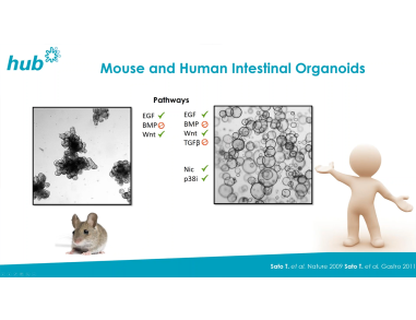 Patient-Derived Organoids for Drug Screening and Development