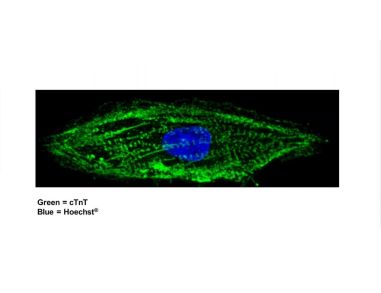 Modeling Arrhythmias Using hPSC-Derived Cardiomyocytes and Tracking Their Excitability