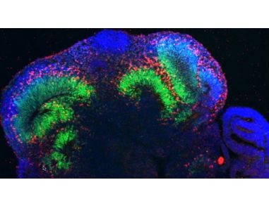 Madeline Lancaster on Brain Organoids: Modeling Human Brain Development in a Dish