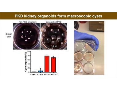 Re-Creating Disease with Kidney Organoids and CRISPR