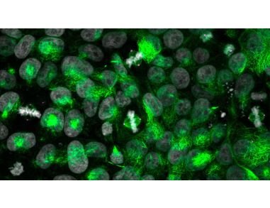 CRISPR-Cas9 Gene Editing of Cerebral Organoids to Model Microcephaly