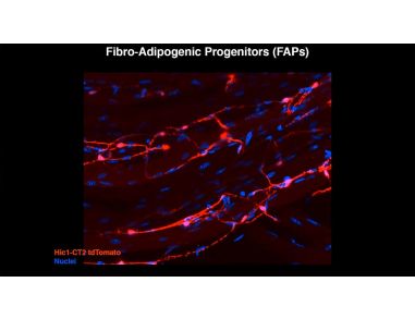The Secret In Vivo Life of "Mesenchymal Stem Cells"