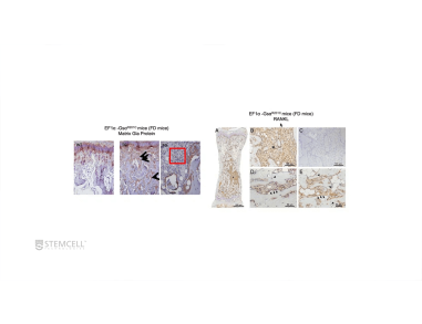 Bone Marrow Skeletal Progenitors and Bone Diseases