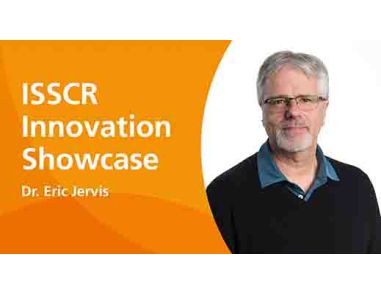 Robust Workflows for the Expansion of PSCs in 3D Suspension Culture