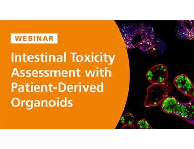 Intestinal Toxicity Assessment with Patient-Derived Organoids
