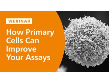 How Primary Cells Can Improve Your Cell-Based Assays
