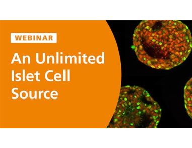 An Unlimited Islet Cell Source