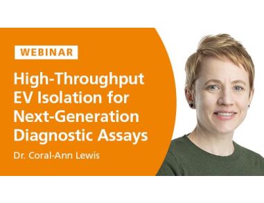 High-Throughput Isolation of Extracellular Vesicles for Next-Generation Diagnostic Assays