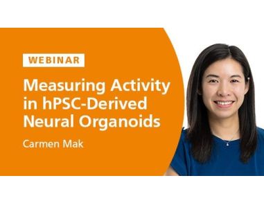 Measuring Activity in hPSC-Derived Neural Organoids