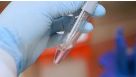 Enzyme-Free Passaging of Human Pluripotent Stem Cells Using ReLeSR™