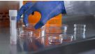 How to Harvest Cells from CFU Assays