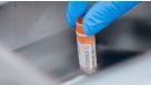 How to Thaw Frozen Primary Cells