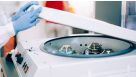 How to Process Leukocyte Reduction System (LRS) Cones/Chambers for Downstream Cell Isolation
