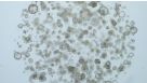 Culturing Intestinal Cancer-Derived Organoids