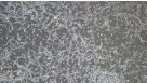 Enzymatic Dissociation of Adult Mouse or Rat CNS Tissue into Single-Cell Suspension