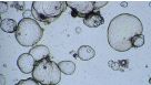 Cryopreserving Hepatic Organoids Expanded in HepatiCult™ Organoid Growth Medium (Human)