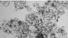 使用HepatiCult™类器官生长培养基在稀释的Matrigel®悬浮液中扩增肝类器官