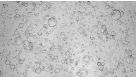 Expansion of Hepatic Organoids via Single Cells Using HepatiCult™ Organoid Growth Medium