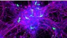 How to Co-Culture Human Pluripotent Stem Cell (hPSC)-Derived Forebrain Neurons and Microglia