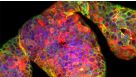 CRISPR-Cas9 Genome Editing of Human Liver Organoids