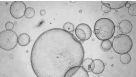 How to Process Epithelial Organoids and Organoid-Derived Epithelial Monolayers for RNA Isolation