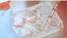 How to Generate Monocyte-Derived Dendritic Cells