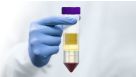 How to Isolate Mononuclear Cells from Blood in 15 Minutes with SepMate™