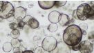 Forskolin-Induced Swelling of Airway Organoids Derived from Healthy and Cystic Fibrosis Donors
