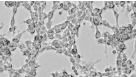 How to Co-Culture Human Airway Epithelial and Immune Cells for RSV Infection