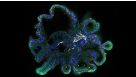 Initiating Intestinal Organoid Differentiation from Single-Cell hPSCs Using STEMdiff™