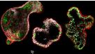 How to Differentiate hiPSCs into Colonic Organoids Using STEMdiff™