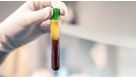 How to Collect Plasma from Whole Blood Before Cell Isolation